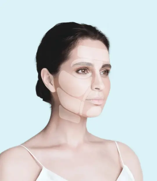 APTOS Thread Lift for Face, Neck, and Body