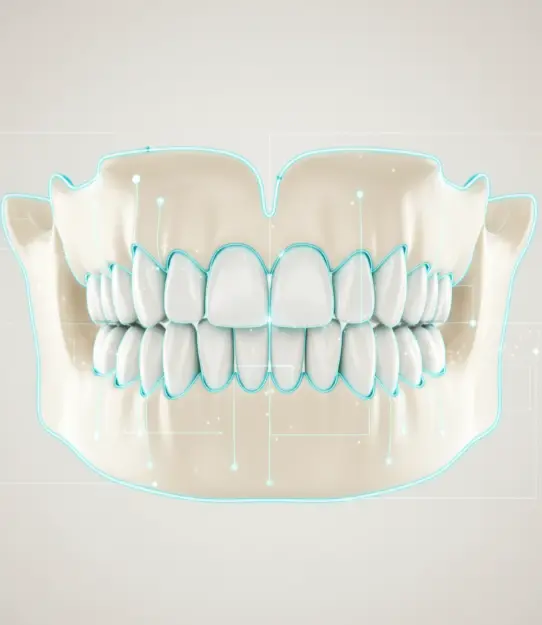 Bone Augmentation + Implantation