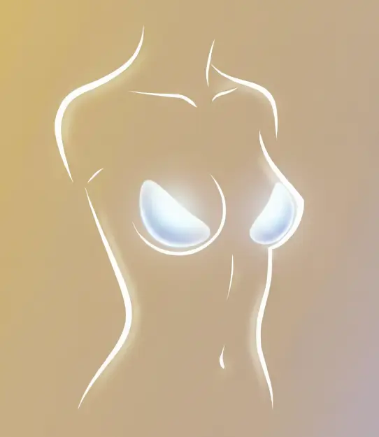 Breast augmentation with implants