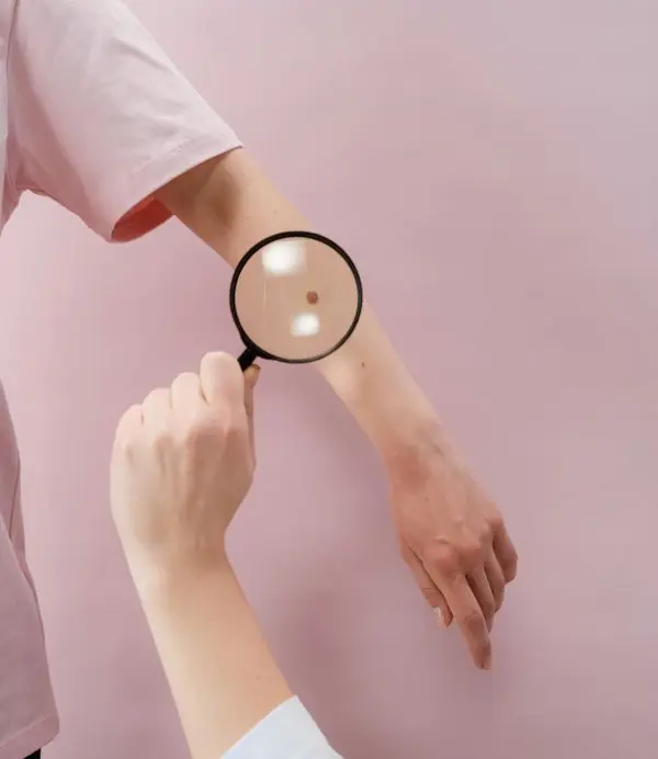 Radiofrequency skin growth removal