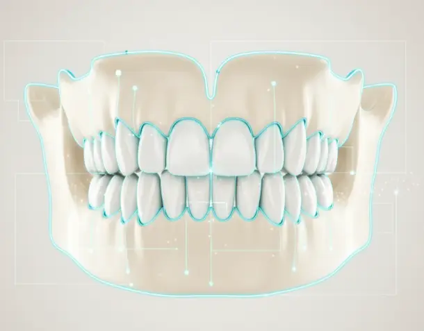 Bone Augmentation + Implantation
