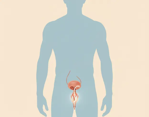 Restoration of Erectile Function with a Malleable Implant