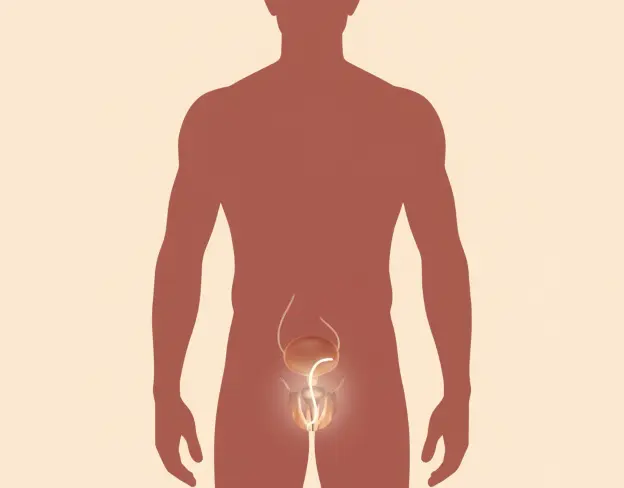 Restoration of Erectile Function with an Inflatable Implant