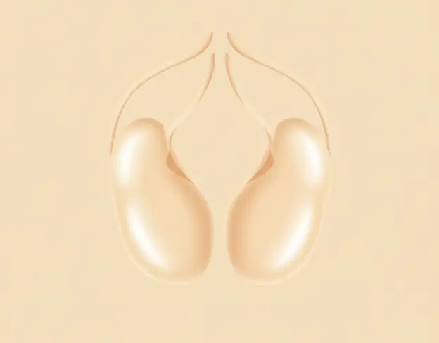 Vasectomy