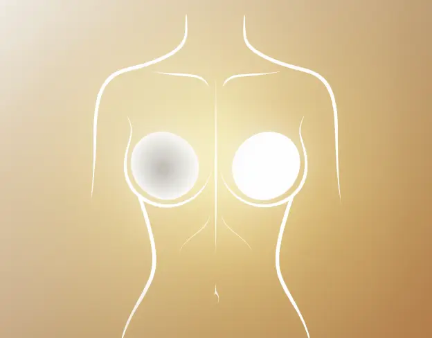 Breast implant replacement