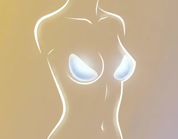 Breast augmentation with implants