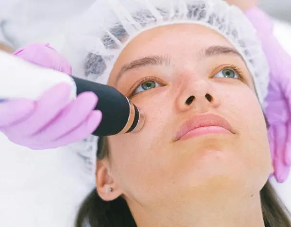 Velure S5 Laser Pigment Removal Procedure