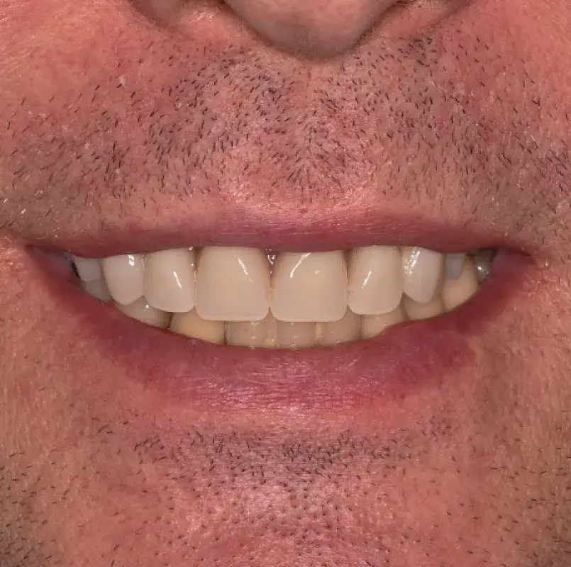 After Image