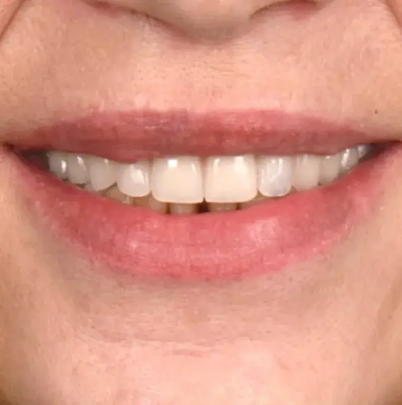 After Image