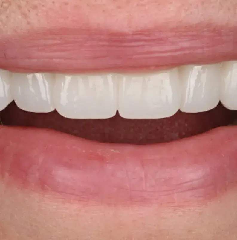 After Image