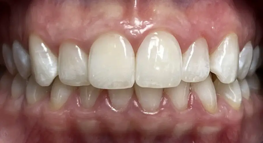 After Image
