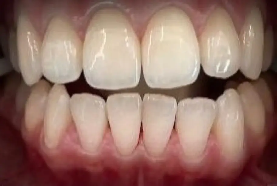 After Image