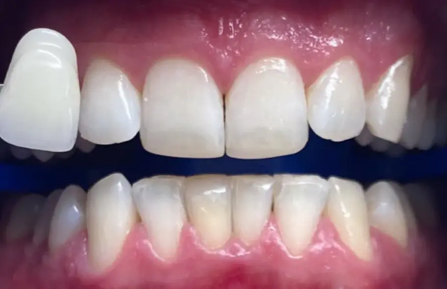 After Image