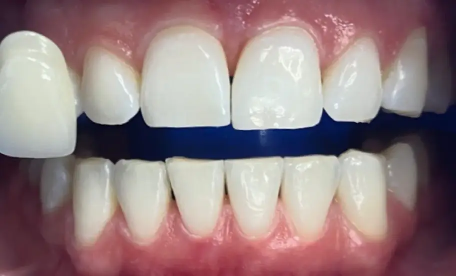 After Image