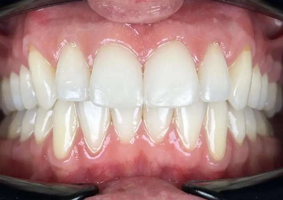 After Image