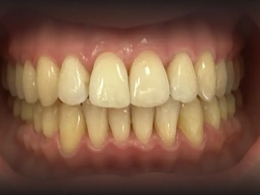 After Image
