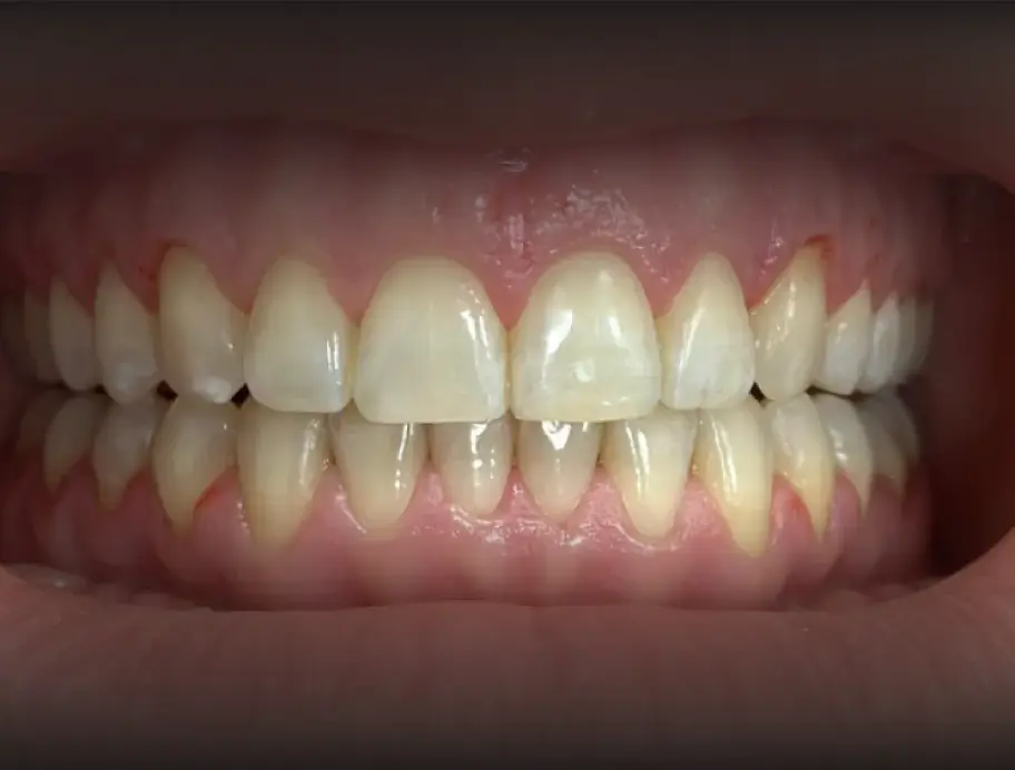 After Image