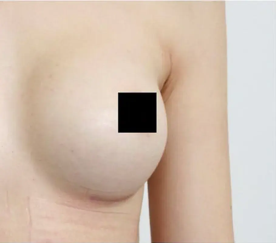 After Image