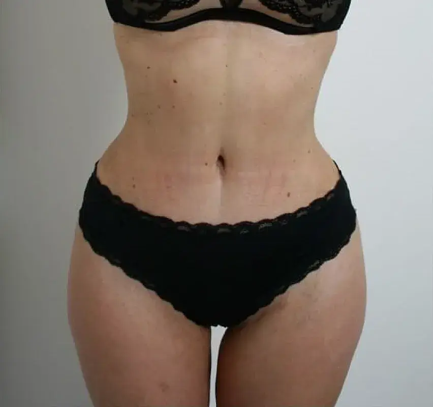 After Image