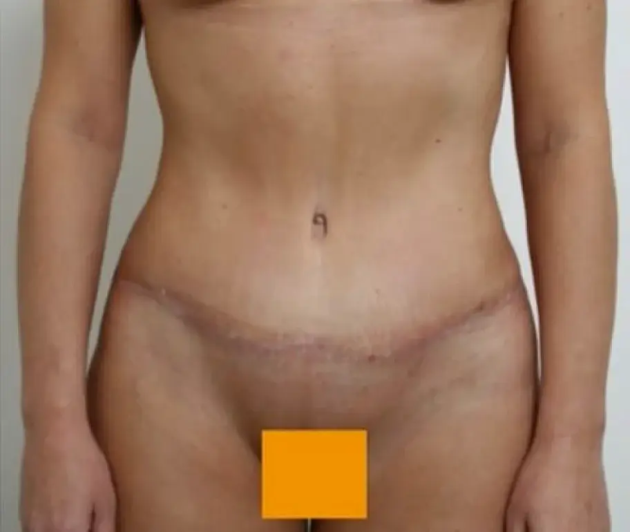 After Image