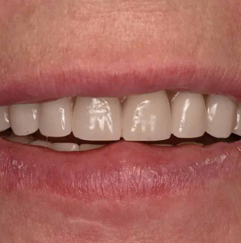 After Image